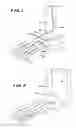Fig. 02 - Systems and methods for installing ankle replacement prostheses