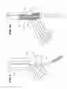 Fig. 05 - Systems and methods for installing ankle replacement prostheses