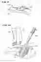 Fig. 08 - Systems and methods for installing ankle replacement prostheses
