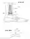 Fig. 10 - Systems and methods for installing ankle replacement prostheses