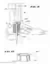 Fig. 11 - Systems and methods for installing ankle replacement prostheses
