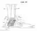 Fig. 13 - Systems and methods for installing ankle replacement prostheses