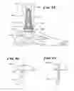 Fig. 14 - Systems and methods for installing ankle replacement prostheses