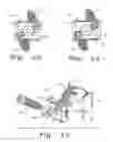 Fig. 05 - Intervertebral fusion implant