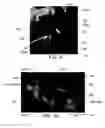 Fig. 07 - PLATE CAGE SYSTEM WITH STANDALONE EFFECTS AND RELATED METHODS