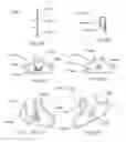 Fig. 10 - Instrumentation and methods for use in implanting a cervical disc replacement device