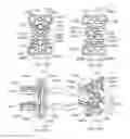 Fig. 16 - Instrumentation and methods for use in implanting a cervical disc replacement device