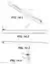 Fig. 16 - Devices and methods for preparation of vertebral members