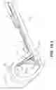 Fig. 28 - Devices and methods for preparation of vertebral members