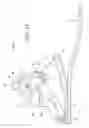 Fig. 34 - Ankle-foot prosthesis for automatic adaptation to sloped walking surfaces