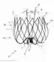 Fig. 01 - Medical implant