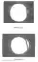 Fig. 22 - BIODEGRADABLE ENDOPROSTHESES AND METHODS FOR THEIR FABRICATION