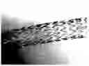 Fig. 01 - Bidirectional stent and method of use thereof