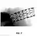 Fig. 07 - Bidirectional stent and method of use thereof