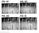 Fig. 09 - Bidirectional stent and method of use thereof