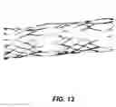 Fig. 13 - Bidirectional stent and method of use thereof