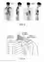 Fig. 03 - Methods and devices for activating brown adipose tissue with targeted substance delivery