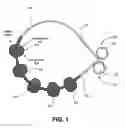 Fig. 02 - METHODS AND DEVICES FOR DELIVERING OR DELAYING LIPIDS WITHIN A DUODENUM