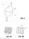 Fig. 03 - METHODS AND DEVICES FOR DELIVERING OR DELAYING LIPIDS WITHIN A DUODENUM
