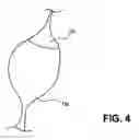 Fig. 05 - METHODS AND DEVICES FOR DELIVERING OR DELAYING LIPIDS WITHIN A DUODENUM