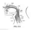 Fig. 71 - Intragastric device