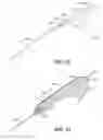 Fig. 74 - Intragastric device