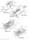 Fig. 79 - Intragastric device