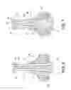 Fig. 06 - Spinal orthosis