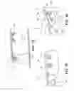 Fig. 13 - Spinal orthosis