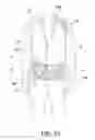 Fig. 14 - Spinal orthosis