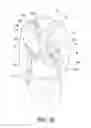 Fig. 15 - Spinal orthosis