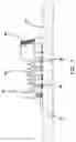 Fig. 08 - Vacuum splint apparatus and method for using the same