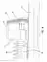 Fig. 07 - Vacuum splint apparatus for accommodating the chin of a patient and method for using the same
