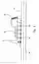 Fig. 08 - Vacuum splint apparatus for accommodating the chin of a patient and method for using the same
