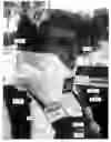 Fig. 12 - Vacuum splint apparatus for accommodating the chin of a patient and method for using the same