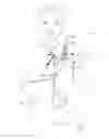 Fig. 01 - Neck Relief Arm Sling