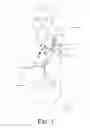 Fig. 02 - Neck Relief Arm Sling