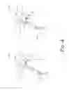 Fig. 05 - Neck Relief Arm Sling