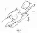 Fig. 05 - POSITIONING ATTACHMENT FOR A PATIENT