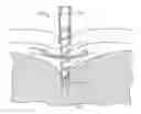 Fig. 01 - Devices and methods for pressure-responsive reshaping of blood vessels