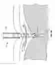 Fig. 04 - Devices and methods for pressure-responsive reshaping of blood vessels