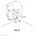 Fig. 07 - Method and apparatus for mandibular support