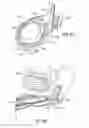 Fig. 09 - Apparatus and method for securing ocular tissue