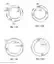 Fig. 15 - Apparatus and method for securing ocular tissue