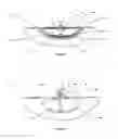 Fig. 07 - Wound cleansing apparatus with stress