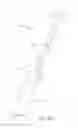 Fig. 08 - Foot stretcher