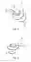 Fig. 10 - Systems and methods for tubing delivery