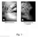 Fig. 02 - Stem cell stimulating compositions and methods
