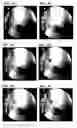 Fig. 04 - Intravascular delivery of nanoparticle compositions and uses thereof