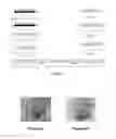 Fig. 04 - Microneedle-based transdermal delivery system and method of making same